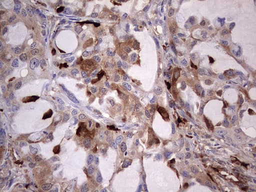 S100A9 / MRP14 Antibody (clone OTI2C5)