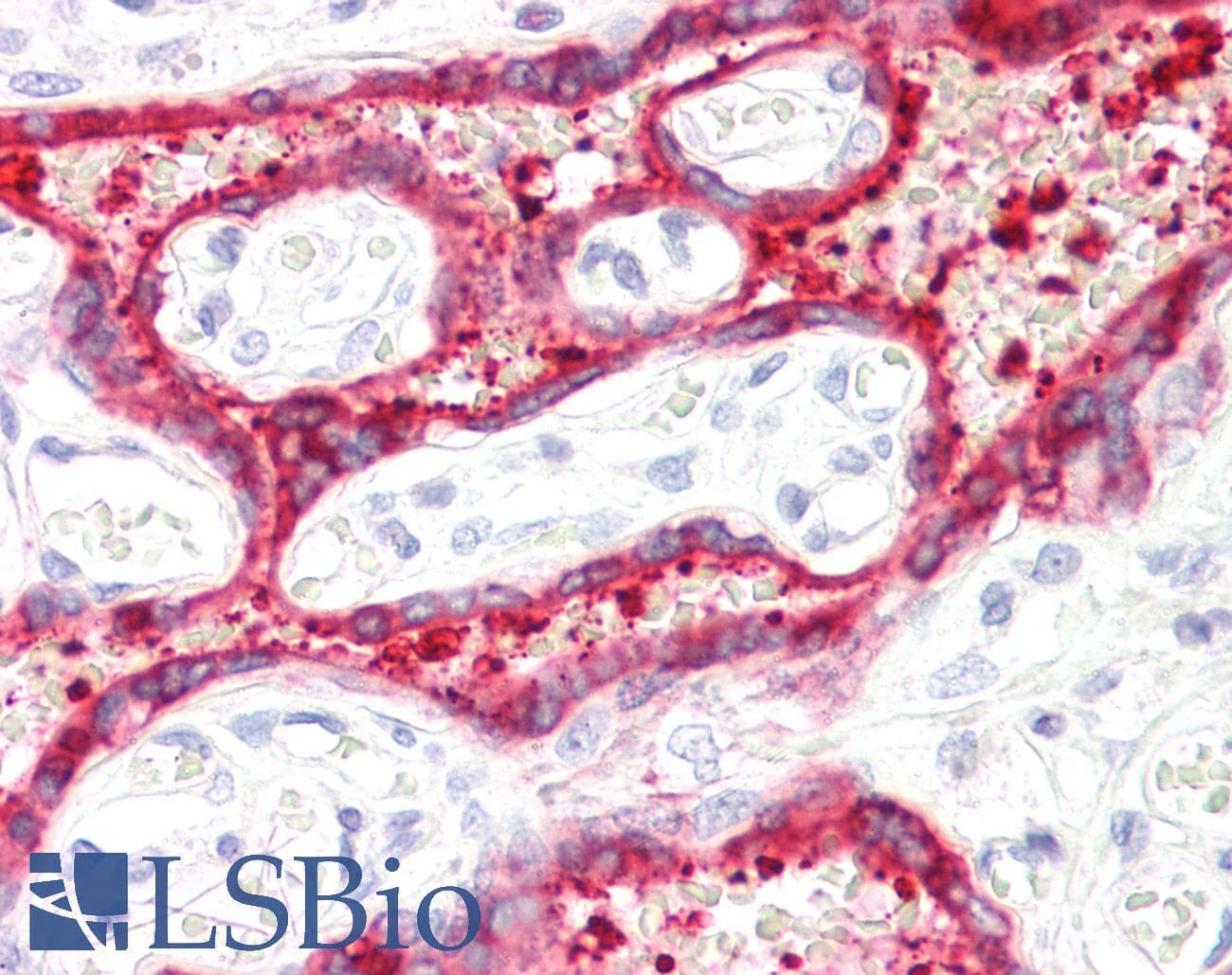 IHC-plus™ Polyclonal Goat anti-Human HSD3B1 Antibody (aa362-373, IHC, WB)