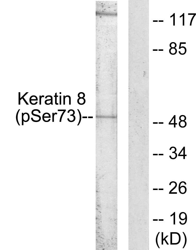 KRT8 / CK8 / Cytokeratin 8 Antibody (phospho-Ser73)
