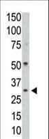 Polyclonal Rabbit anti-Human PPP1CC / PP1 Gamma Antibody (aa1-30, WB)