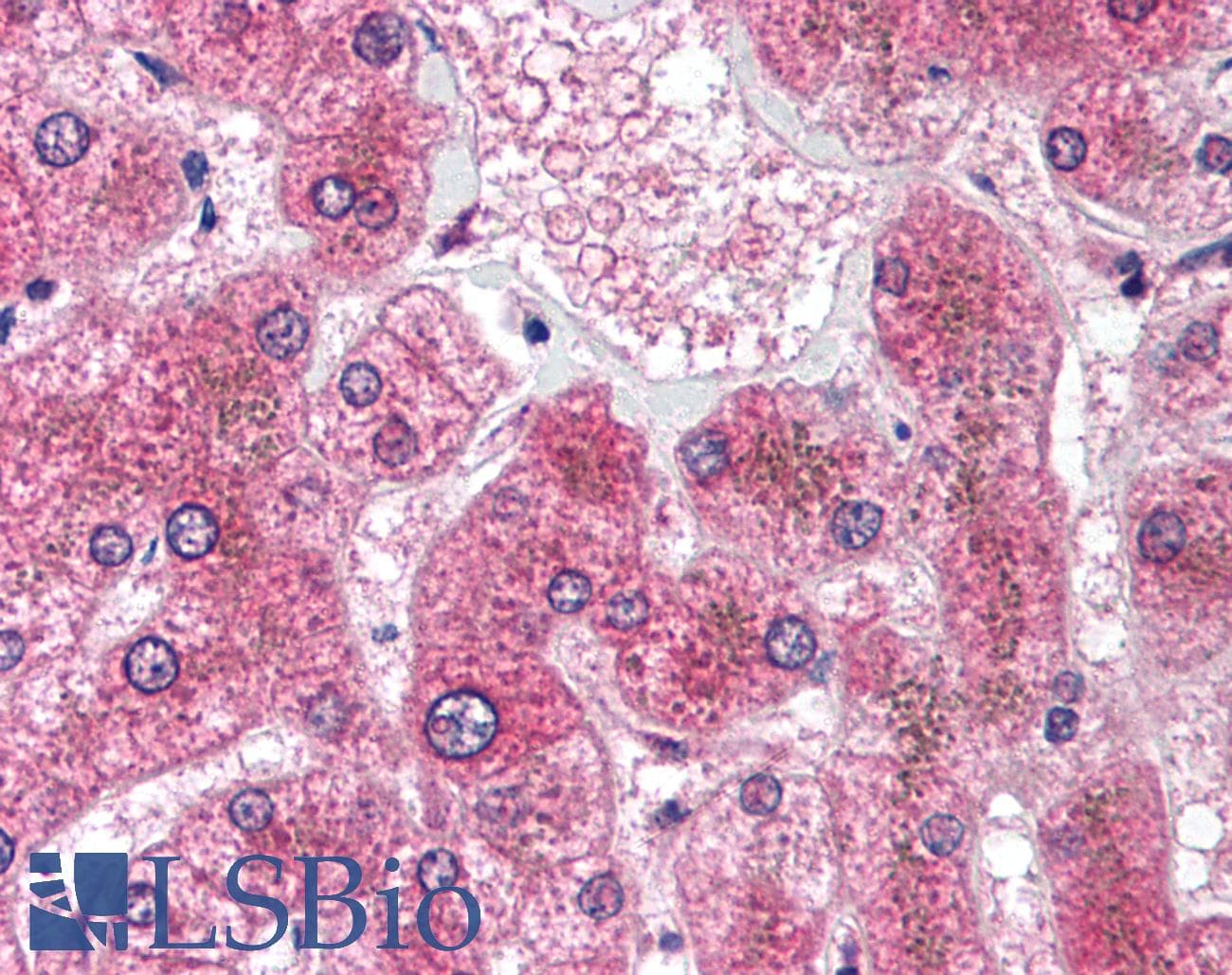 IHC-plus™ Polyclonal Rabbit anti-Human HSD11B1 / HSD11B Antibody (aa77-92, IHC, WB)