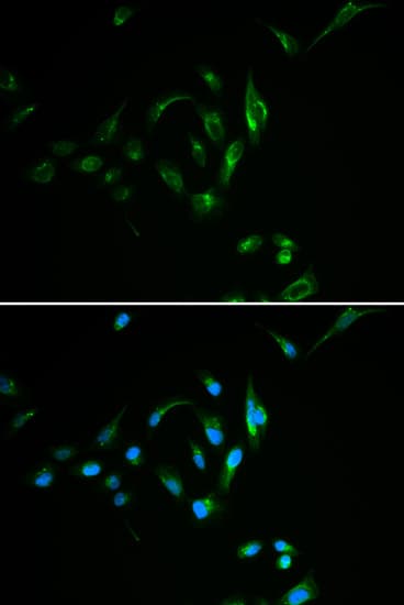 Polyclonal Rabbit anti-Human CPT2 Antibody (IHC, IF, WB)