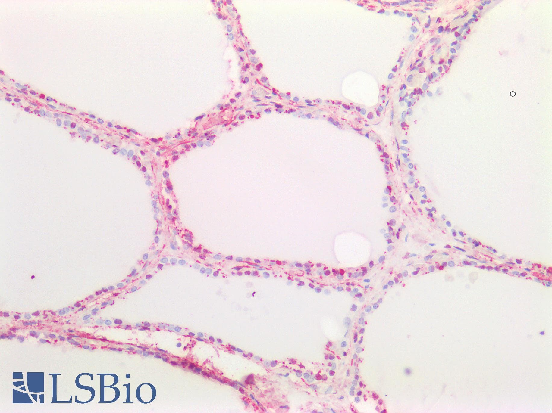 IHC-plus™ CTGF Antibody (Amino Acids 111-123)