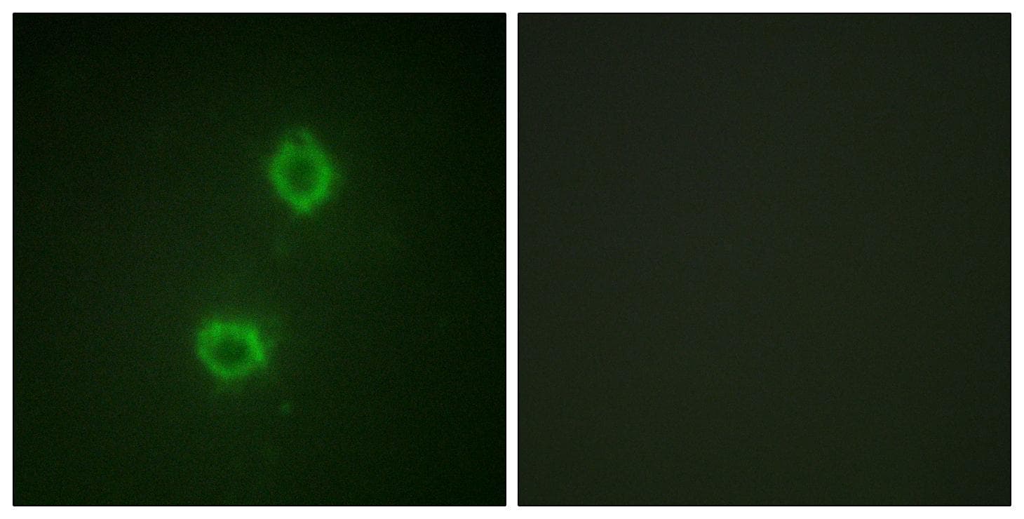 FGFR1 / FGF Receptor 1 Antibody (p654)