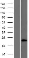 SAMD5 Protein (Over-Expression Lysate Myc-DDK (Flag))