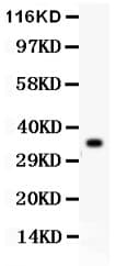 Polyclonal Rabbit anti-Human GPX1 / Glutathione Peroxidase Antibody (aa116-146, IHC, WB)