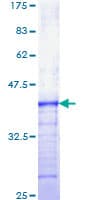 Human FGFR3 Protein (Recombinant GST, N-terminus)