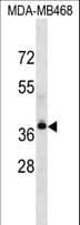 LPAR4 / GPR23 Antibody (aa127-156)