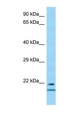 TCF23 Antibody (aa92-141)
