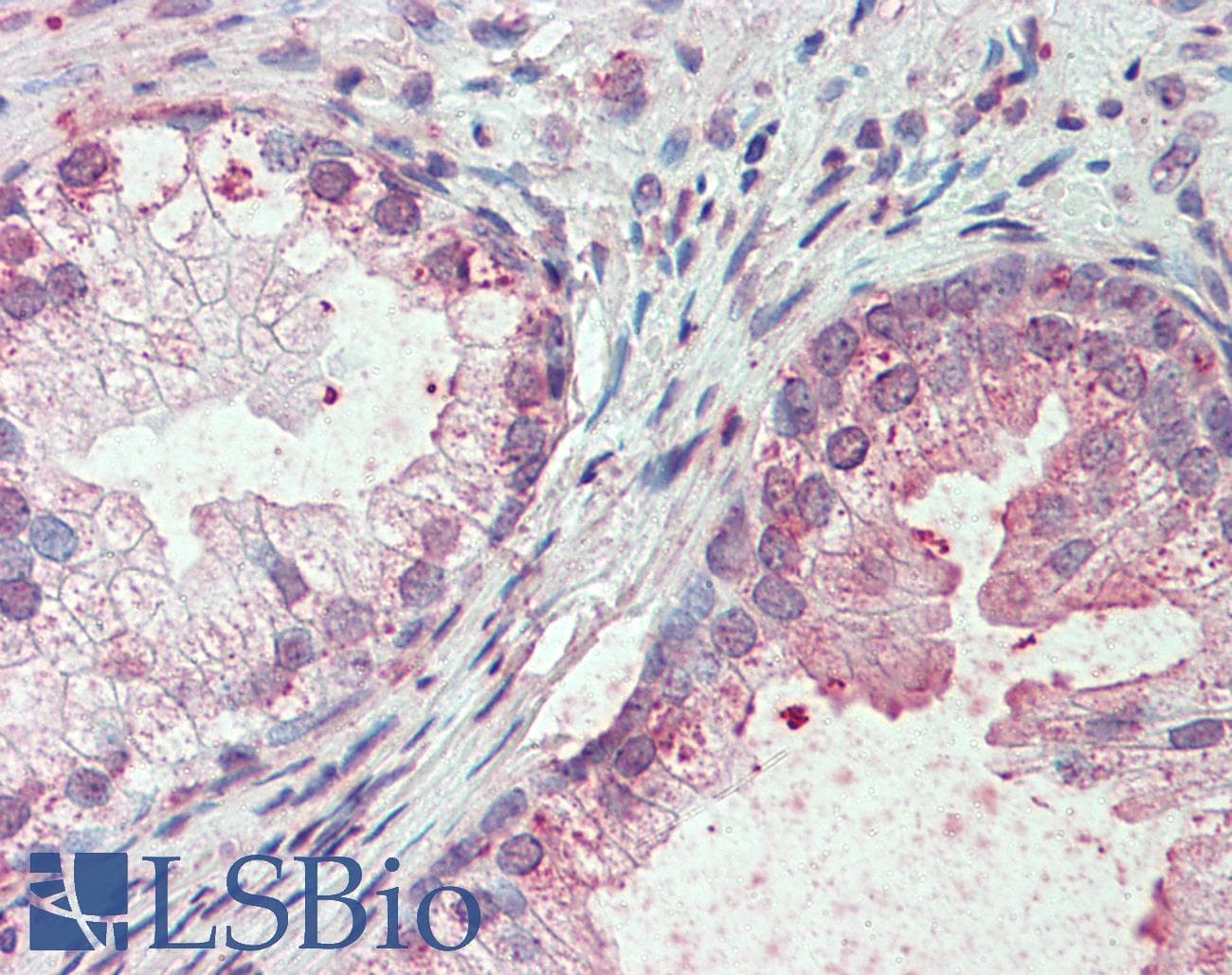 IHC-plus™ SLC44A2 / CTL2 Antibody (Internal)