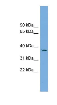 FKBPL Antibody (aa71-120)