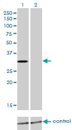 Monoclonal Mouse anti-Human KCNIP2 / KCHIP2 Antibody (clone 3E7, WB)