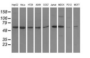 ADSL / Adenylosuccinate Lyase Antibody (clone OTI2D10)