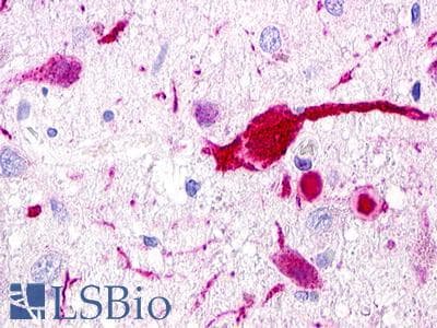 PathPlus™ GPR62 Antibody (C-Terminus)