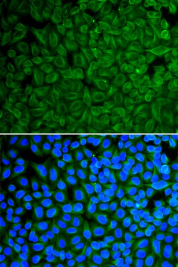 GAD65 Antibody