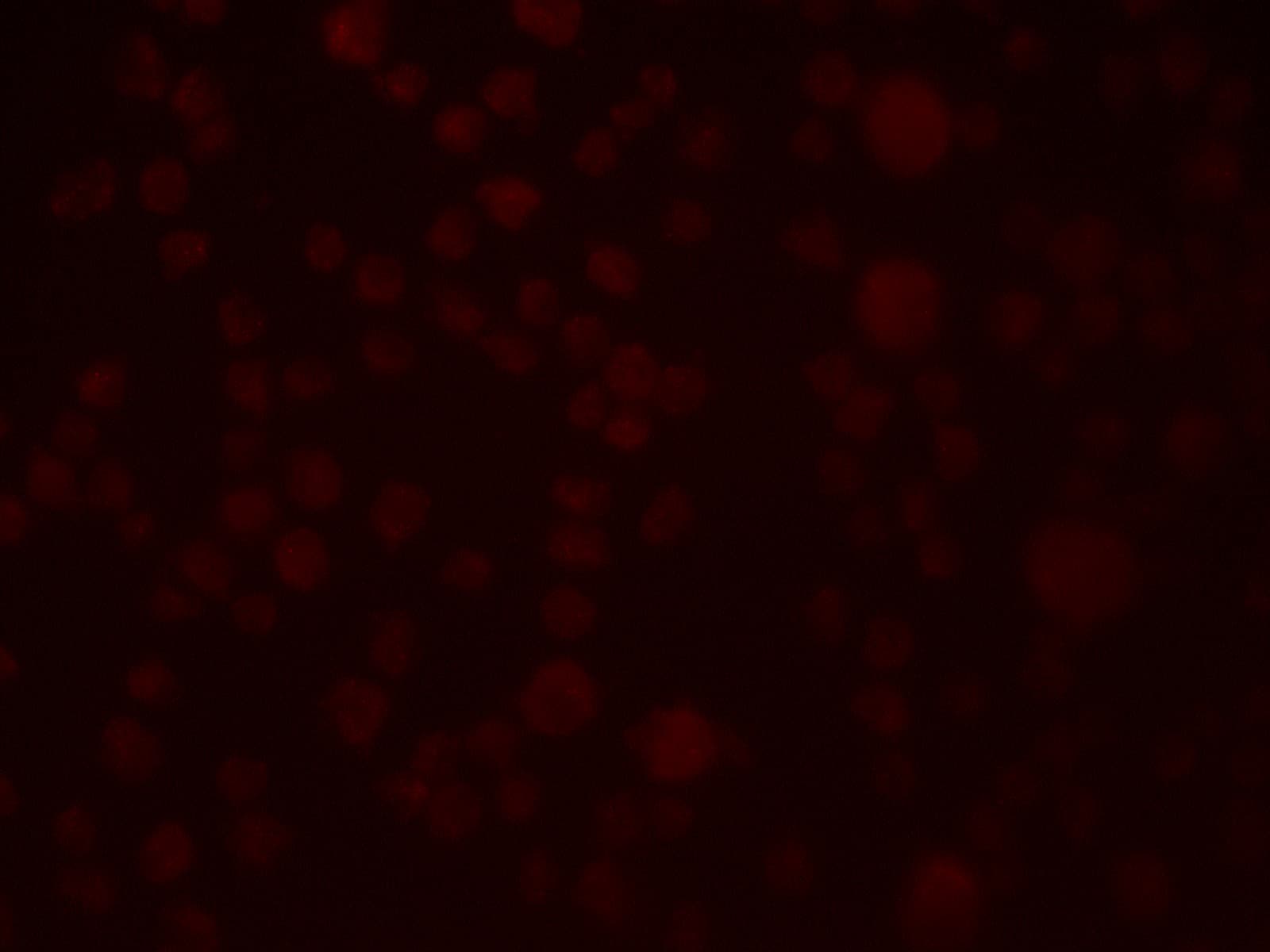 IHC-plus™ SLAIN1 Antibody