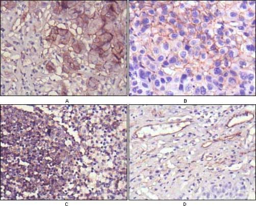 NT5E / eNT / CD73 Antibody (clone 1D7)
