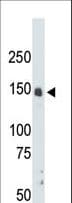 CDK12 / CRKRS Antibody (aa1-30)