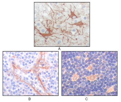 FES Antibody (clone 2E3G3)