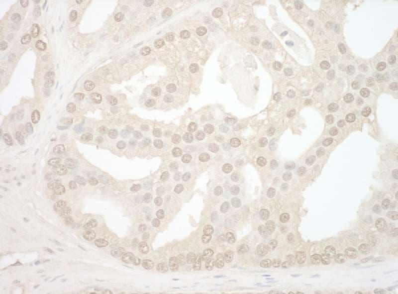 Polyclonal Rabbit anti-Human NOL12 Antibody (aa75-125, IHC)
