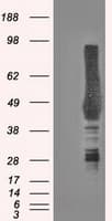 Monoclonal Mouse anti-Human CA9 / Carbonic Anhydrase IX Antibody (clone OTI1G7, IHC, WB)