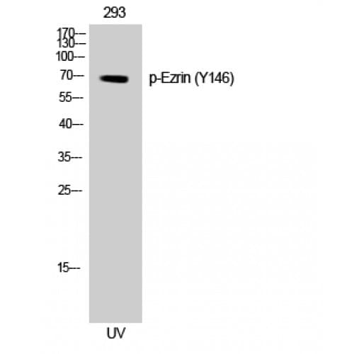 Polyclonal Rabbit anti-Human EZR / Ezrin Antibody (80-160 aa, WB)