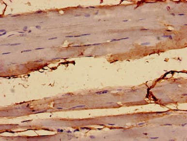 PCA1 / ALKBH3 Antibody (aa1-170)