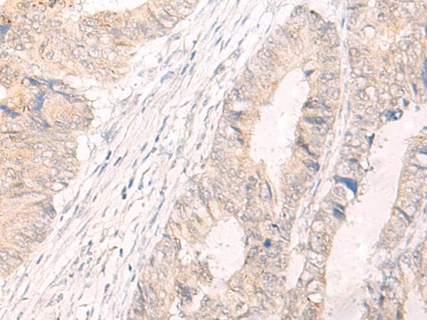 IL-33 Antibody