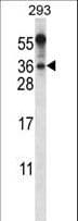 BEND6 Antibody (aa226-254)
