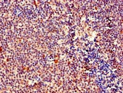 Polyclonal Rabbit anti-Human MEF2D Antibody (IHC, WB)