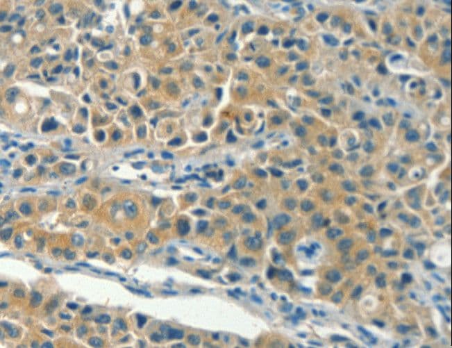 KLC1 / Kinesin Light Chain 1 Antibody