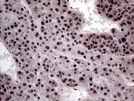 PPP4C Antibody (clone OTI2E4)