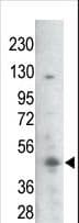 GSK3B / GSK3 Beta Antibody (phospho-Ser21/Ser29)