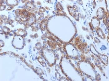 TSH Receptor / TSHR Antibody (clone TSHRB/1405, Azide-free, BSA-free)