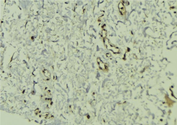 CMPK / CMPK1 Antibody