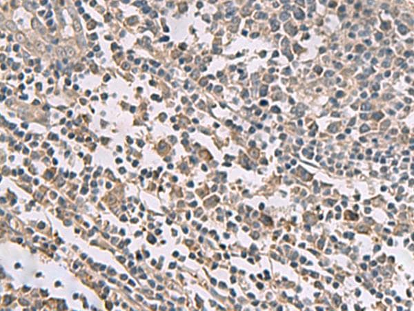 TMEM141 Antibody
