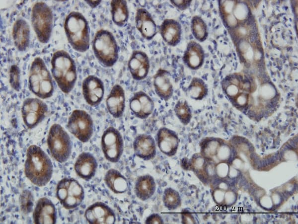 Monoclonal Mouse anti-Human ZPR1 / ZNF259 Antibody (clone 6F7, IHC, WB)