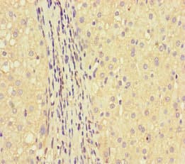 Polyclonal Rabbit anti-Human GLUL / Glutamine Synthetase Antibody (IHC, IF, WB)