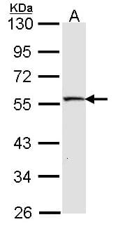 Polyclonal Rabbit anti-Human STK26 / MST4 Antibody (aa352-416, IHC, WB)