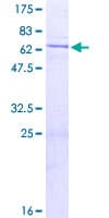 Human DUSP11 Protein (Recombinant GST)