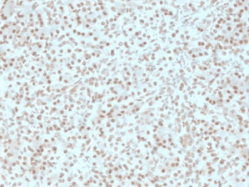 AKT1 Antibody (clone AKT1/2491)