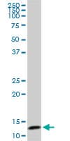 TCEB2 / Elongin B Antibody (clone 6F6)