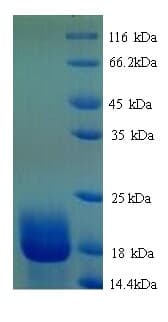 Rat AIF1 / IBA1 Protein (Recombinant His)