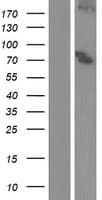 ALOX15B / 15-LOX-2 Protein (Over-Expression Lysate Myc-DDK (Flag))