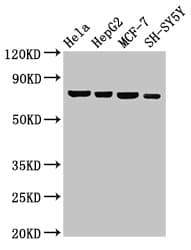 Polyclonal Rabbit anti-Human NFE2L3 Antibody (IHC, WB)