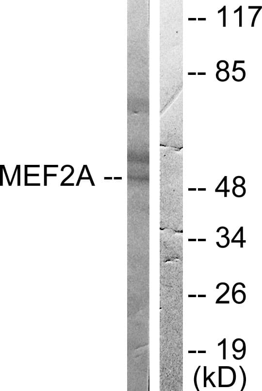 IHC-plus™ MEF2A / MEF2 Antibody (aa374-423)