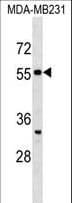 Polyclonal Rabbit anti-Human SEPT10 /Septin 10 Antibody (aa14-40, WB)