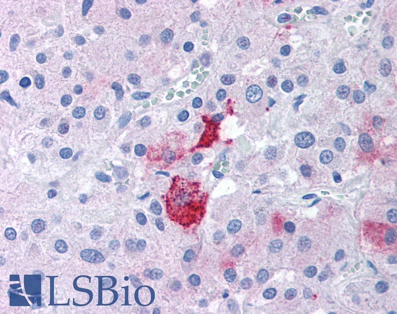 IHC-plus™ EPHX2 / Epoxide Hydrolase 2 Antibody (N-Terminus)