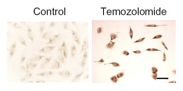 IHC-plus™ MAP1LC3B / LC3B Antibody (N-Terminus)