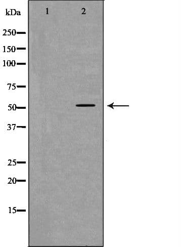 PEPD / PROLIDASE Antibody